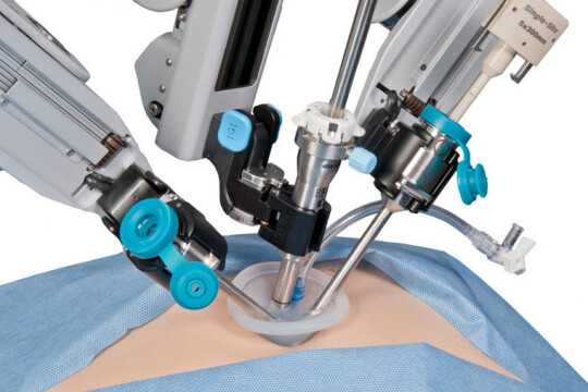 A robot has performed laparoscopic surgery without human